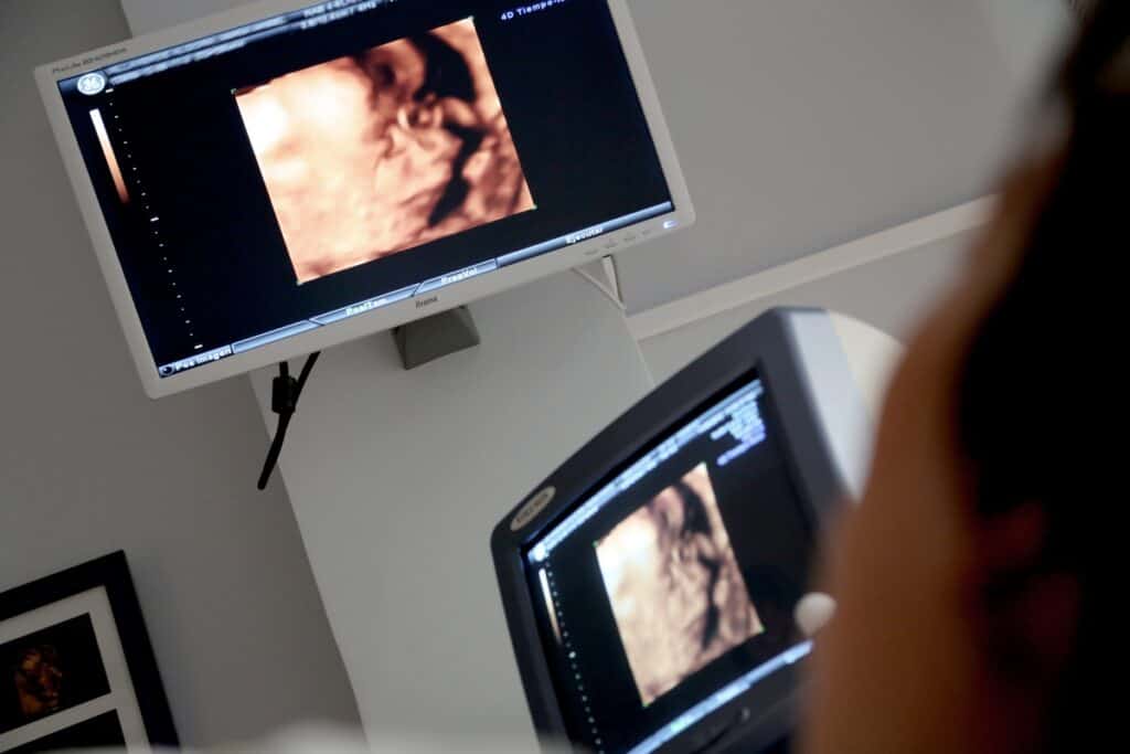 An ultrasound screen is shown from the point of view of a patient.